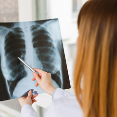 Вплив вейпінгу на флюорографію: що показує знімок легенів